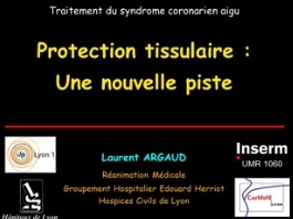 Traitement du syndrome coronarien aigu - Protection tissulaire : une nouvelle piste Traitement du syndrome coronarien aigu - Protection tissulaire : une nouvelle piste