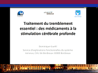 Traitement du tremblement essentiel : des médicaments à la stimulation cérébrale profonde