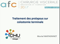 Traitement prolapsus sur colostomie terminale