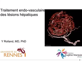 Traitements endo-vasculaires Traitements endo-vasculaires
