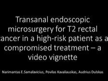 Transanal Endoscopic Microsurgery for T2 Rectal Cancer in a High Risk Patient as Compromise Therapy Transanal Endoscopic Microsurgery for T2 Rectal Cancer in a High Risk Patient as Compromise Therapy