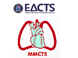 Transapical approach to optimize left ventricular resynchronization