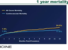 Transcatheter Aortic Valve Replacement