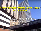 Transcatheter mitral repair overview