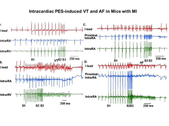 Transciptional Regulation of Cardiac Na+ Channel