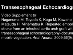 Transesophageal Echocardiography Transesophageal Echocardiography