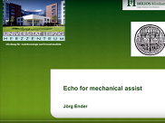 Transoesophageal echocardiography in Mechanical Assist