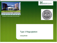 Transoesophageal echocardiography type III mitral regurgitation