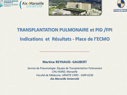 Transplantation pulmonaire et ECMO au cours des pneumopathies interstitielles diffuses Transplantation pulmonaire et ECMO au cours des pneumopathies interstitielles diffuses
