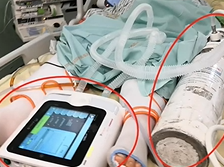 Transport d'un patient ventilé