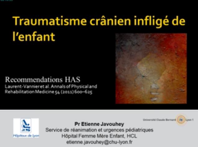 2015/2015_43eme_congres_international_de_la_SRLF/Traumatisme_cranien_inflige/SRLF_2015_a_l_enfant_x264.mp4