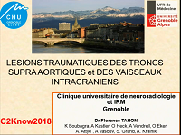 Traumatismes massif facial et rocher