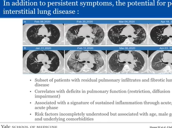 Treating Long COVID: Clinician Experience with Post-Acute COVID-19 Care Treating Long COVID: Clinician Experience with Post-Acute COVID-19 Care