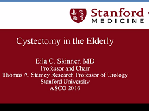 Treatment of Muscle-Invasive Bladder Cancer in Older Patients Treatment of Muscle-Invasive Bladder Cancer in Older Patients