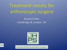 Résultats du traitement pour la chirurgie arthroscopique