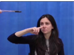 Tremor and Myoclonus Due To Action Myoclonus Renal Failure Syndrome (AMRFS) Tremor and Myoclonus Due To Action Myoclonus Renal Failure Syndrome (AMRFS)