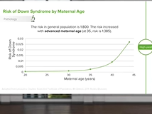 Trisomy 21: Etiology, Pathology, Diagnosis & Management - Pediatrics