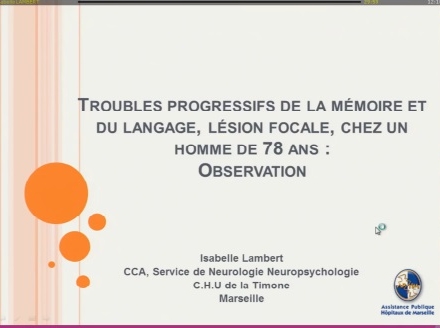 Troubles progressifs de la mémoire et du langage, lésion focale, chez un homme de 78 ans : OBSERVATION