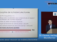 Trucs et astuces pour réussir sa trabeculectomie