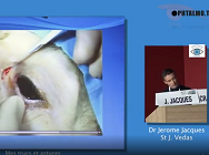 Trucs et astuces pour réussir une DCRS externe et interne