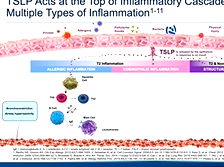 TSLP in Asthma: Examining the Evidence