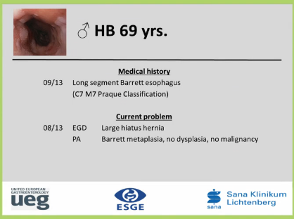 UEG Week 2013 - Confocal evaluation of the Barrett's Oesophagus UEG Week 2013 - Confocal evaluation of the Barrett's Oesophagus
