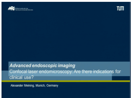 UEG Week 2013 - Confocal laser endomicroscopy: Are there indications for clinical use? UEG Week 2013 - Confocal laser endomicroscopy: Are there indications for clinical use?