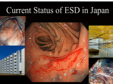 UEG Week 2013 - Current status of ESD in Japan UEG Week 2013 - Current status of ESD in Japan