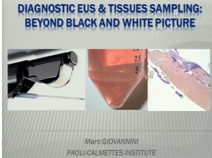 UEG Week 2013 - Diagnostic EUS and tissues sampling. Beyond black and white picture UEG Week 2013 - Diagnostic EUS and tissues sampling. Beyond black and white picture