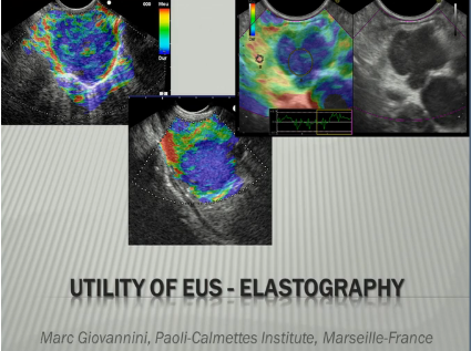 UEG Week 2013 - Endoscopic elastography vs. EUS of the pancreas UEG Week 2013 - Endoscopic elastography vs. EUS of the pancreas