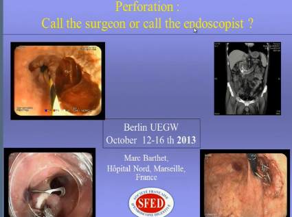 UEG Week 2013 - Endoscopic perforations UEG Week 2013 - Endoscopic perforations