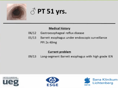 UEG Week 2013 - Evaluation of long segment Barratt's UEG Week 2013 - Evaluation of long segment Barratt's