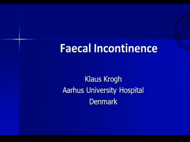 UEG Week 2013 - Faecal incontinence UEG Week 2013 - Faecal incontinence