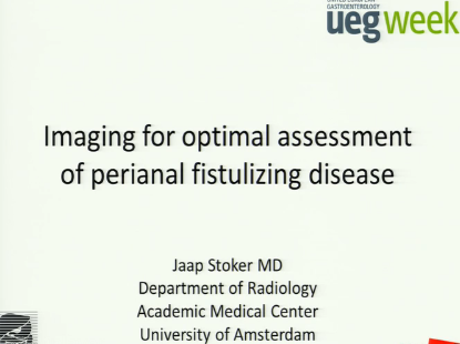 UEG Week 2013 - Imaging for optimal assessment of perianal fistulizing disease UEG Week 2013 - Imaging for optimal assessment of perianal fistulizing disease