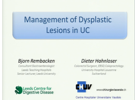 UEG Week 2013 - Management of dysplastic lesions in ulcerative colitis UEG Week 2013 - Management of dysplastic lesions in ulcerative colitis