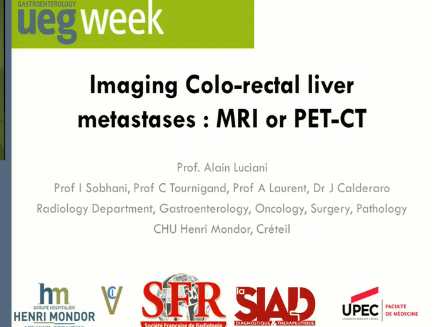 UEG Week 2013 - MRI or PET-CT for colorectal liver metastases? UEG Week 2013 - MRI or PET-CT for colorectal liver metastases?