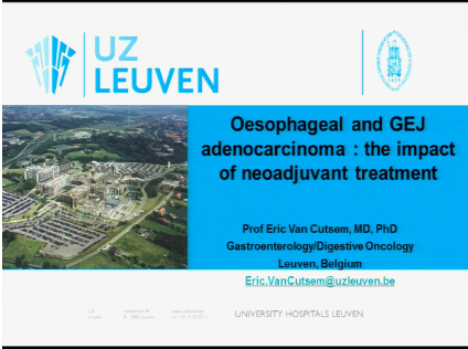 UEG Week 2013 - Neo-adjuvant treatment in Oesophageal Adenocarcinoma: Results and impact UEG Week 2013 - Neo-adjuvant treatment in Oesophageal Adenocarcinoma: Results and impact