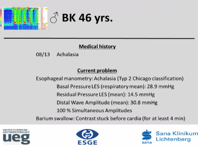 UEG Week 2013 - Per-oral endoscopic myotomy (POEM) UEG Week 2013 - Per-oral endoscopic myotomy (POEM)