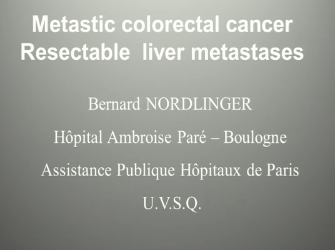 UEG Week 2013 - Primary resectable liver metastases: What are the criteria and how should they be treated? UEG Week 2013 - Primary resectable liver metastases: What are the criteria and how should they be treated?
