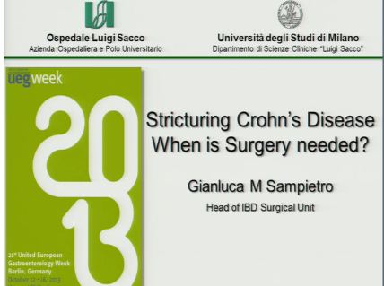 UEG Week 2013 - Surgical management of Crohn's strictures UEG Week 2013 - Surgical management of Crohn's strictures