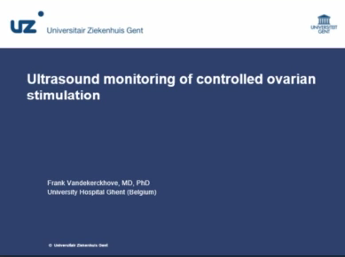 Ultrasound monitoring of controlled ovarian stimulation