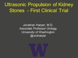 Propulsion d'ultrasons sur calculs rénaux