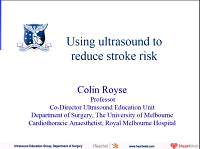 Ultrasound to reduce CVA in off pump CABG