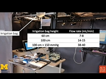 Understanding Non-Contact Laser Lithotripsy For Dusting