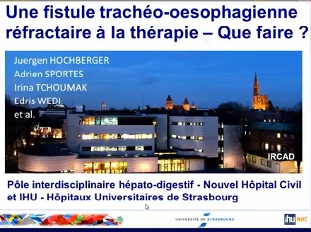 Une fistule trachéo-œsophagienne réfractaire à la thérapie : que faire ?