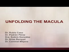 Unfolding the Macula Unfolding the Macula