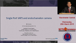 Uniportal VATS endochamelon camera