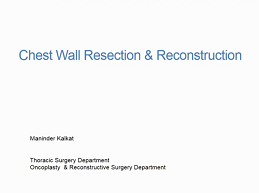 Update of reconstructive strategies in chest wall resection