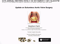 Update on sutereless valve technology - who and when