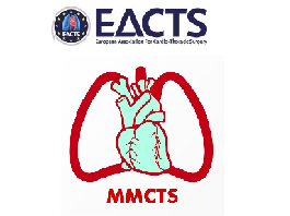 Upper hemisternotomy